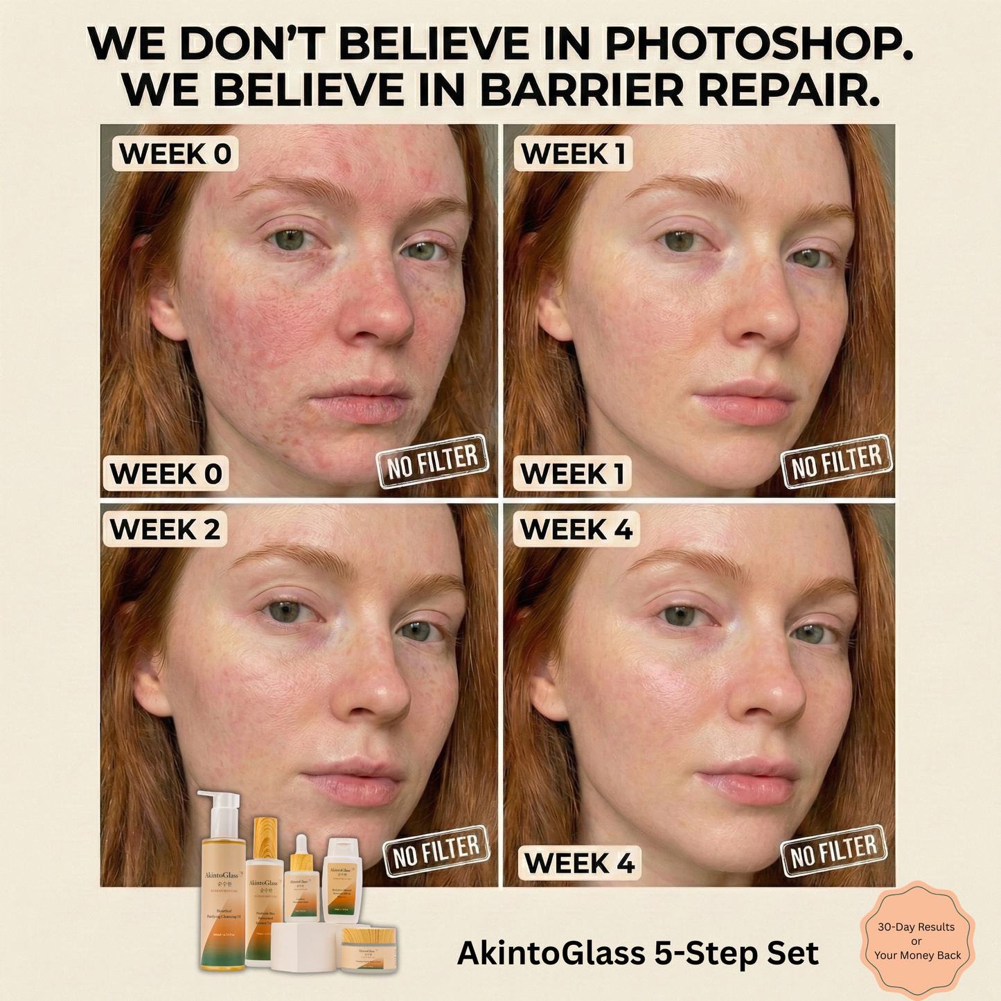 The Barrier Repair Ritual™ A 5-Step System for Reactive, Compromised Skin